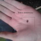 kokon dżdżownicy